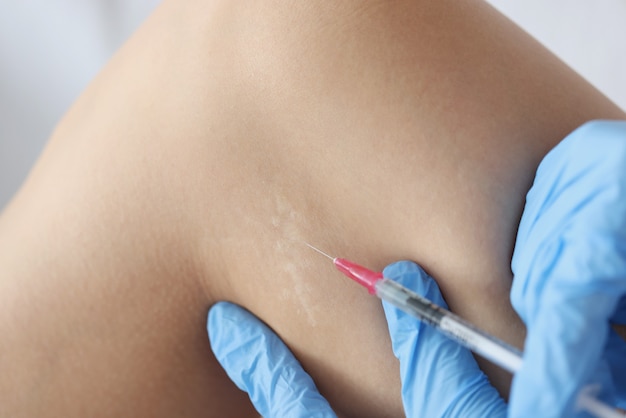 Photo doctor in gloves injecting medicine into scar on skin of patient leg closeup. aesthetic medicine scar correction concept