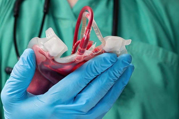 Foto un medico in tuta chirurgica verde e guanto blu con in mano una sacca di sangue