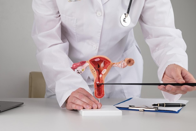 Doctor gynecologist pointing model of female reproductive system on his desktop