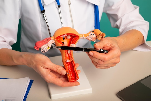 Doctor gynecologist showing pen on plastic model of uterus and ovaries closeup