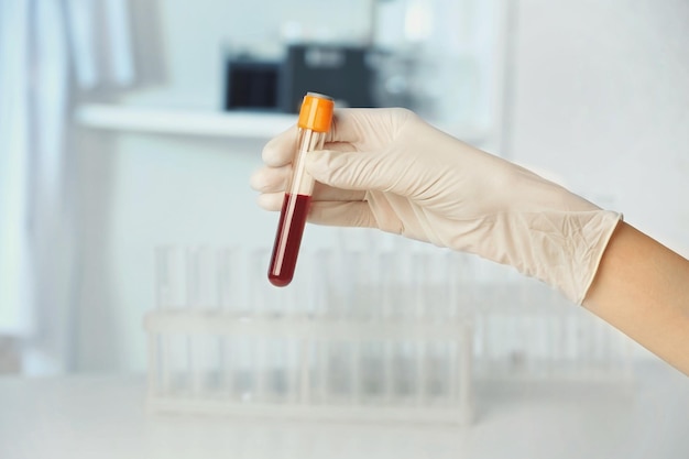 doctor hand in glove holding test tube with blood on blurred background