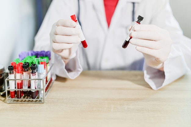 Доктор Рука Холдинг трубка для анализа крови, медицинское оборудование трубки для анализа крови в лаборатории