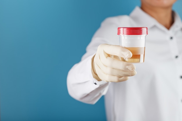 Foto mano del medico che tiene l'analisi delle urine in un contenitore