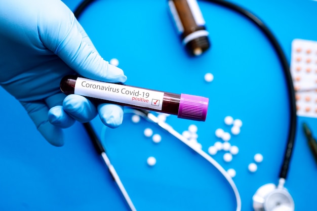 Foto mano del medico in provetta per guanti medica con esito positivo del test del sangue per coronavirus (covid-19)