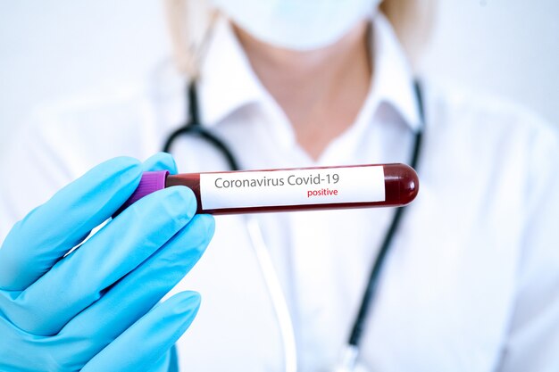 Doctor hand in medical glove holding tube with positive blood test result for rapidly spreading Coronavirus 2019-nCoV in laboratory. Coronavirus Covid-19 outbreaking. Medicine and epidemic concept.