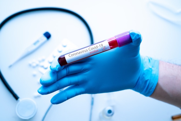 Foto mano del medico in provetta per guanti medica con risultato positivo del test del sangue per la rapida diffusione del coronavirus covid-19 in laboratorio. concetto di medicina ed epidemia.