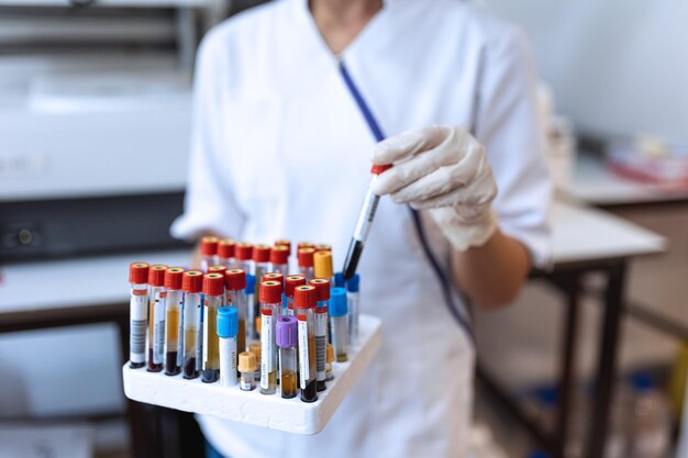 Doctor hand taking a blood sample tube from a rack with machines of analysis in the lab background Technician holding blood tube test in the research laboratory