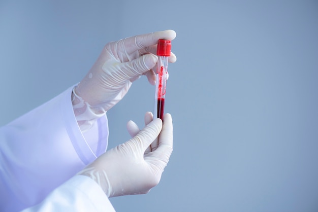 Doctor hand with latex glove holding Blood test tube on Sterile room