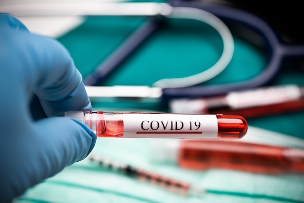 Mani del medico che tengono il sangue del test del coronavirus covid 19. avvicinamento