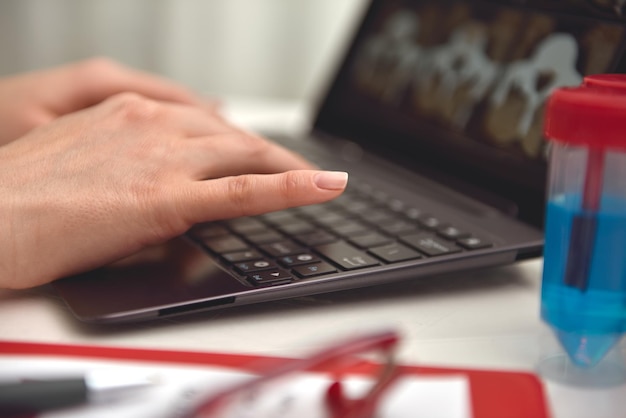 Doctor hands typing on laptop