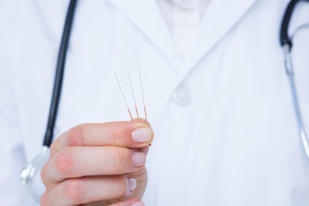 Doctor holding acupuncture needles 