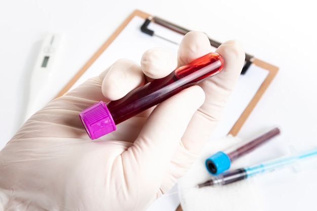 Photo doctor holding blood test over spreadsheet for analysis.