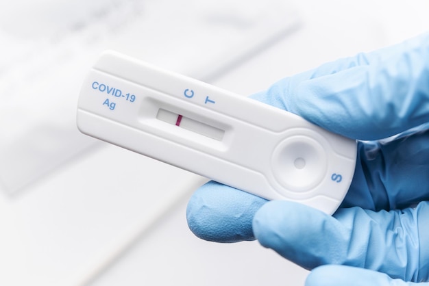 Doctor holding a negative result for COVID19 with test kit for viral disease