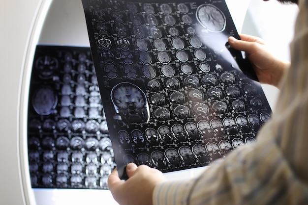 Doctor holding a picture of a brain MRI workflow in diagnostic hospital