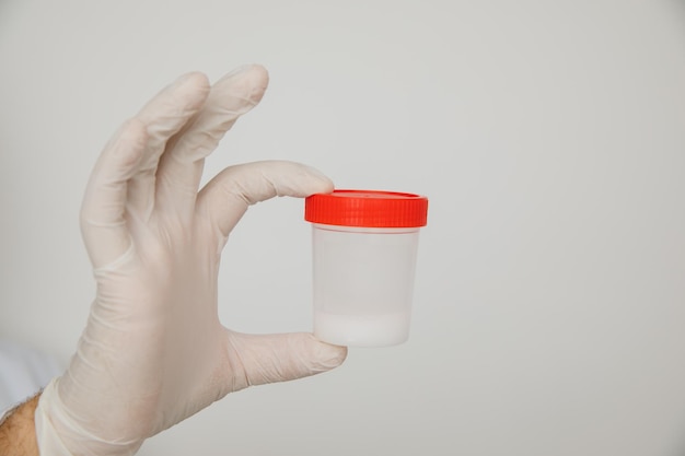 白で隔離される精液分析のための精子が入ったプラスチック製の瓶を持っている医師。病院での医療検査。