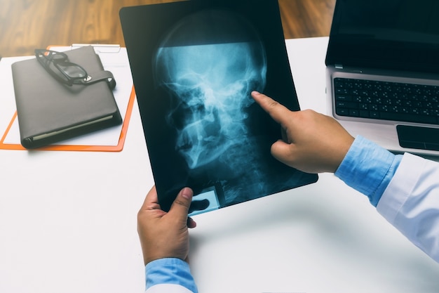 Doctor holding and pointing on x-ray film of patient.