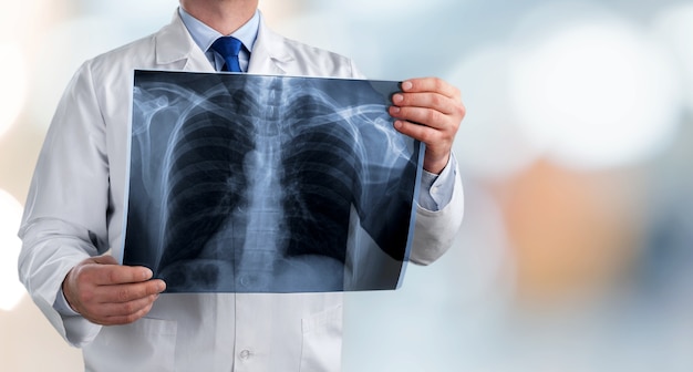 Доктор держит рентгеновский снимок рентгеновского снимка на фоне больницы
