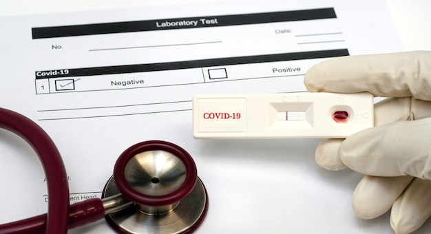 Doctor holding a test kit for viral disease CoronavirusCOVID19 Lab card kit test for viral novel