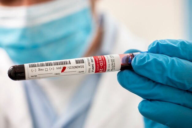 Doctor holding test tube blood sample