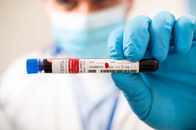 Doctor holding test tube blood sample