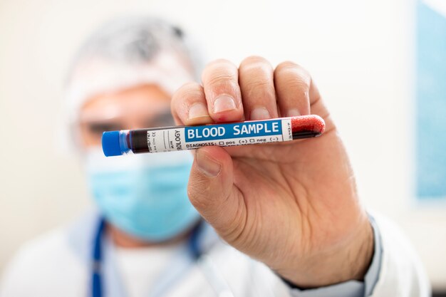 Doctor holding test tube blood sample