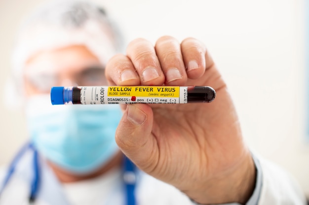 Doctor holding test tube blood sample