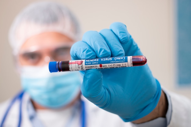 Doctor holding test tube blood sample