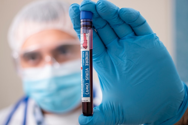 Doctor holding test tube blood sample