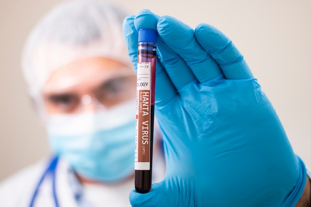 Doctor holding test tube blood sample