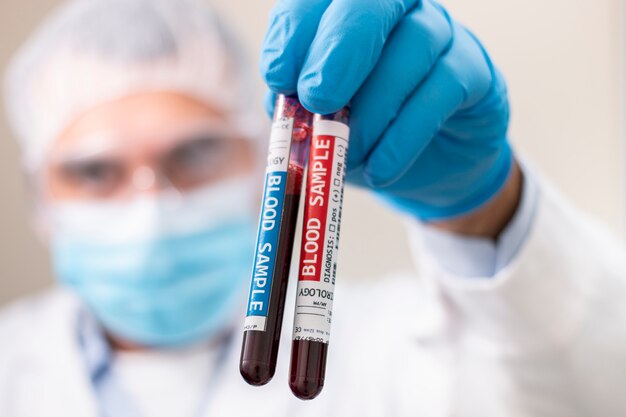 Doctor holding test tube blood sample