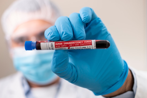 Doctor holding test tube blood sample