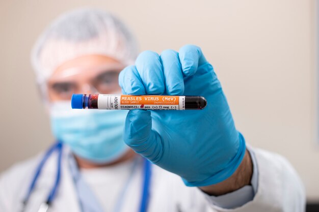 Doctor holding test tube blood sample