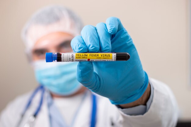 Doctor holding test tube blood sample