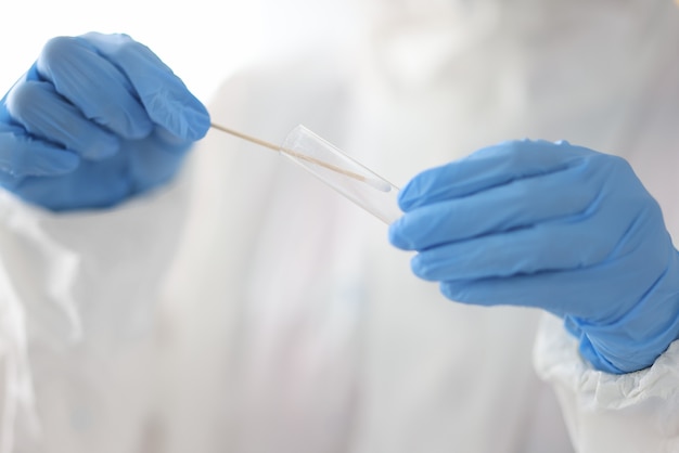 Doctor holding test tube and cotton swab