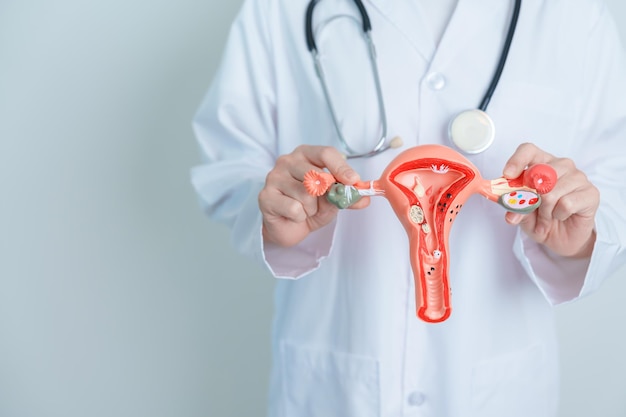 자궁 및 난소 모델을 들고 있는 의사 난소 및 자궁경부암 자궁경부 장애 자궁내막증 자궁 절제술 자궁 근종 생식계 및 임신 개념