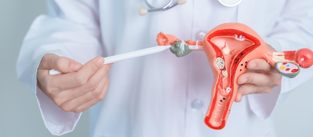 Photo doctor holding uterus and ovaries model ovarian and cervical cancer cervix disorder endometriosis hysterectomy uterine fibroids reproductive system and pregnancy concept