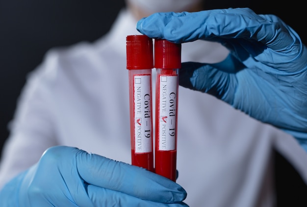 Doctor holding vials with blood