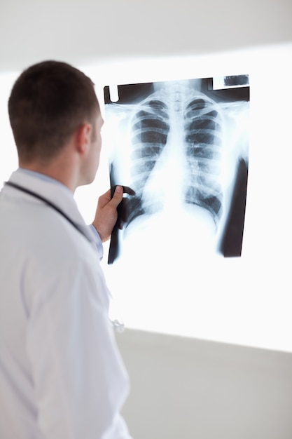 Doctor holding x-ray against light