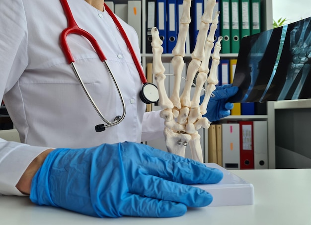 Photo doctor holds in hands xray of the hand and model of skeleton of hands