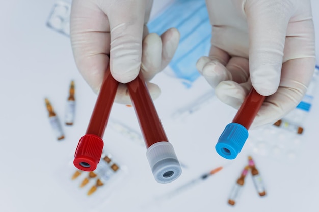 The doctor holds in his hands three tubes with blood tests there are medicines in the background