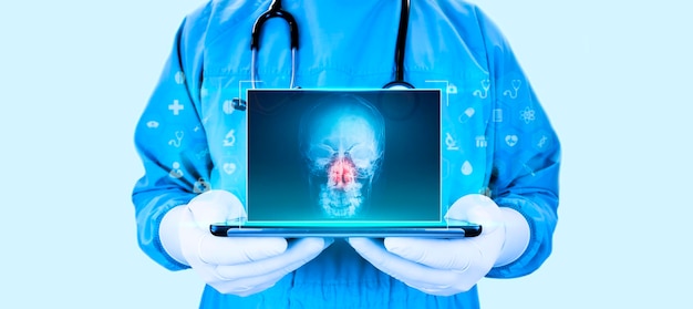 doctor holds a skull xray with a fracture in the nose sky background