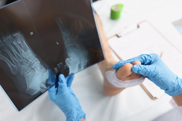 Doctor holds xray with dislocated leg of patient lying on table foot injury and sprain and