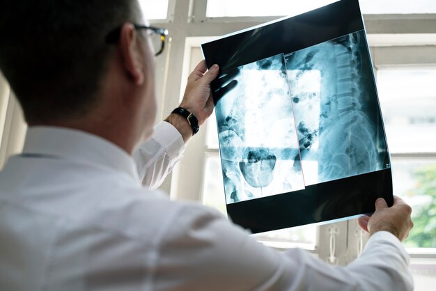 Photo doctor is checking patient x-ray film