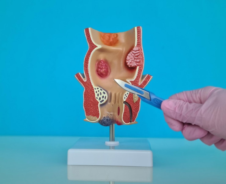 Photo doctor is holding scalpel anatomy of rectum problem
