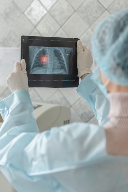 A doctor is looking at a fluorography scan of a patient with coronavirus disease.