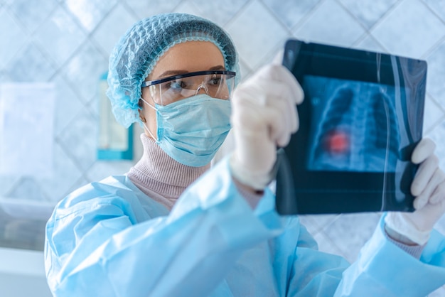 A doctor is looking at a fluorography scan of a patient with coronavirus disease