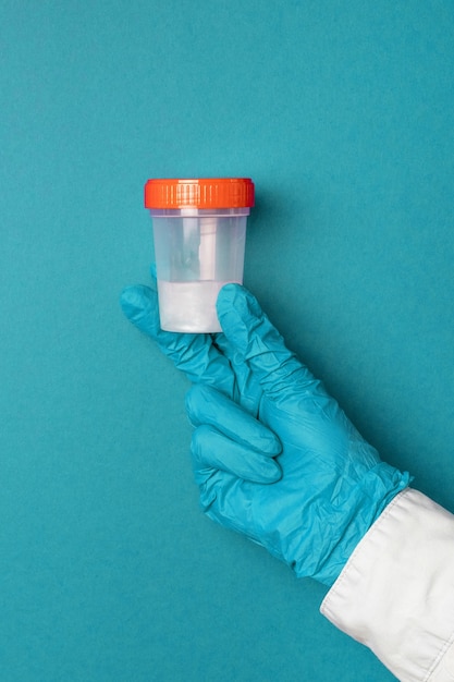 Doctor in latex gloves holds a plastic container with semen or saliva samples on a blue background. Medical concept.