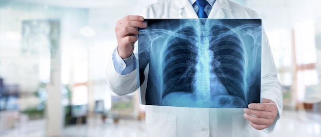 Doctor looking chest x-ray film in hospital