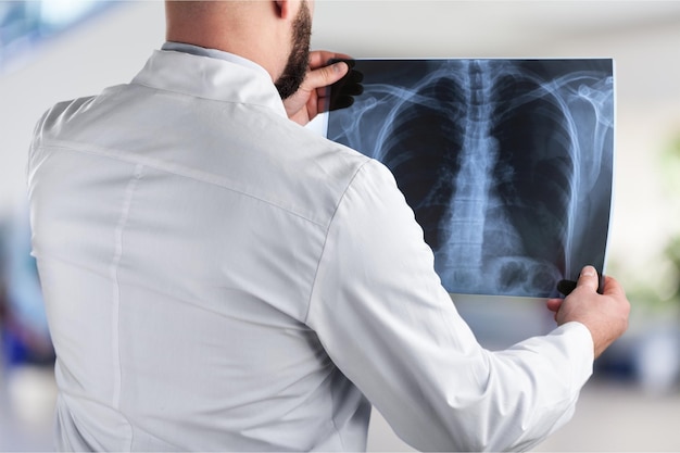 Doctor looking chest x-ray film in hospital.