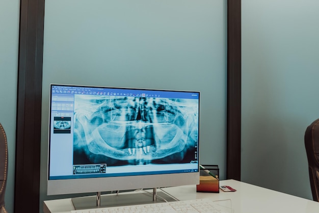 Doctor looking at human teeth x-ray on a computer monitor. Modern dental clinic. High quality photo